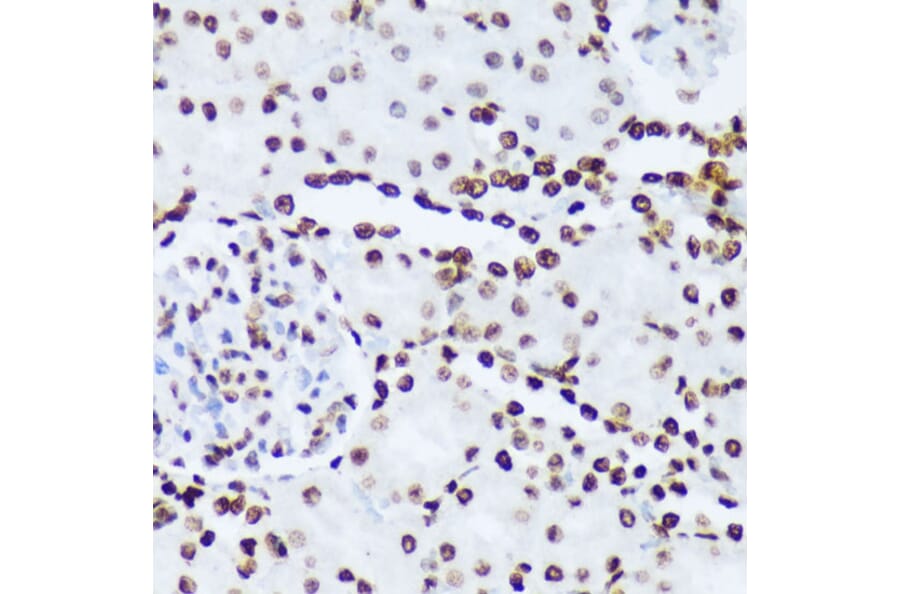 Immunohistochemistry - Anti-ABL1 (phospho Tyr245) Antibody (A12447) - Antibodies.com