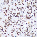 Immunohistochemistry - Anti-ABL1 (phospho Tyr245) Antibody (A12447) - Antibodies.com