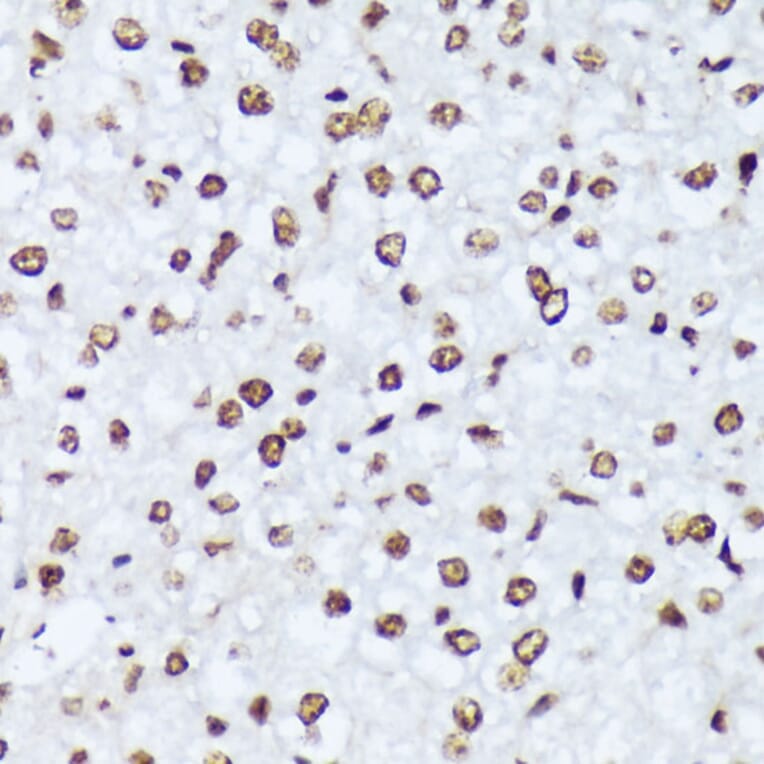 Immunohistochemistry - Anti-ABL1 (phospho Tyr245) Antibody (A12447) - Antibodies.com