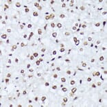 Immunohistochemistry - Anti-ABL1 (phospho Tyr245) Antibody (A12447) - Antibodies.com