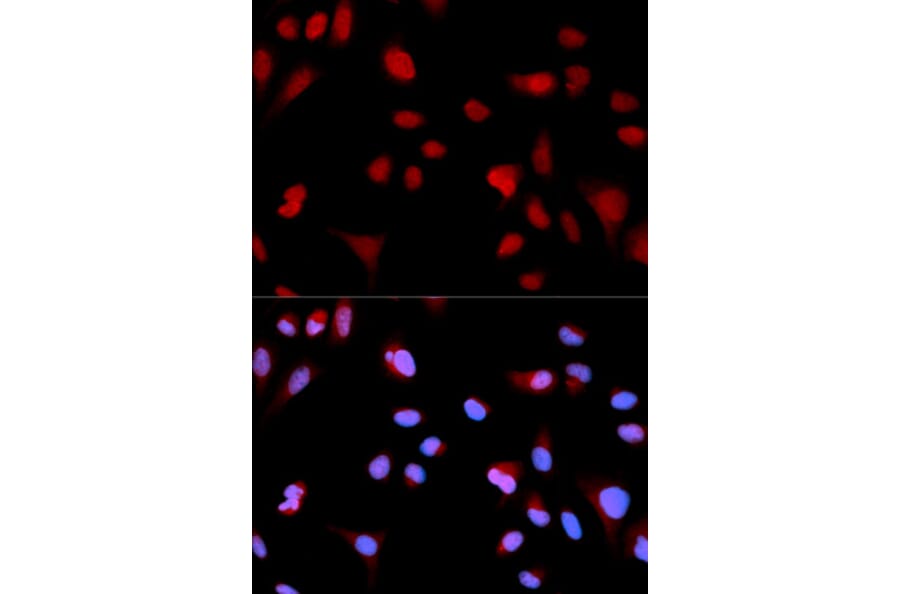 Immunofluorescence - Anti-ABL1 (phospho Y204) Antibody (AP0003) - Antibodies.com