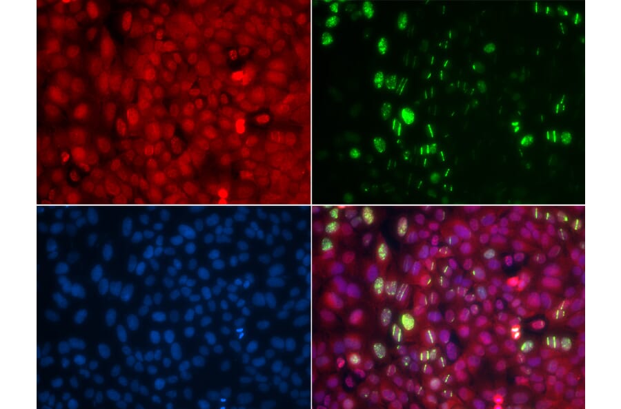 Immunofluorescence - Anti-ABL1 (phospho Y204) Antibody (AP0003) - Antibodies.com