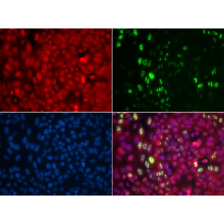 Immunofluorescence - Anti-ABL1 (phospho Y204) Antibody (AP0003) - Antibodies.com
