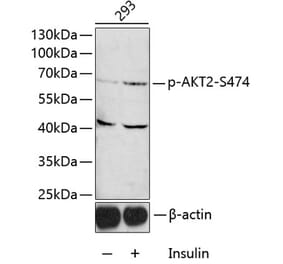 Western Blot - Anti-AKT2 (phospho Ser474) Antibody (A12450) - Antibodies.com