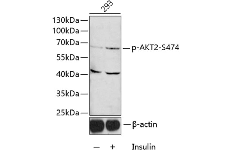 Western Blot - Anti-AKT2 (phospho Ser474) Antibody (A12450) - Antibodies.com