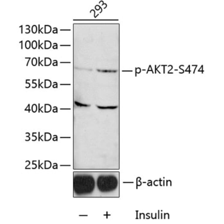 Western Blot - Anti-AKT2 (phospho Ser474) Antibody (A12450) - Antibodies.com