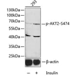 Western Blot - Anti-AKT2 (phospho Ser474) Antibody (A12450) - Antibodies.com