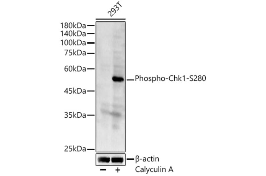 Western Blot - Anti-Chk1 (phospho Ser280) Antibody (A12451) - Antibodies.com