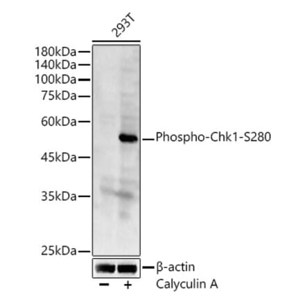 Western Blot - Anti-Chk1 (phospho Ser280) Antibody (A12451) - Antibodies.com