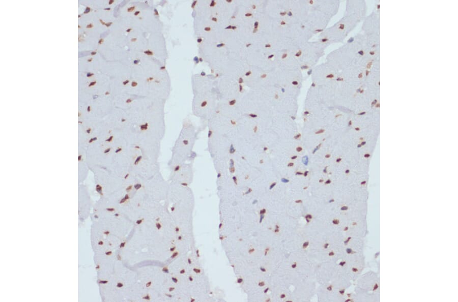 Immunohistochemistry - Anti-Chk1 (phospho Ser280) Antibody (A12451) - Antibodies.com