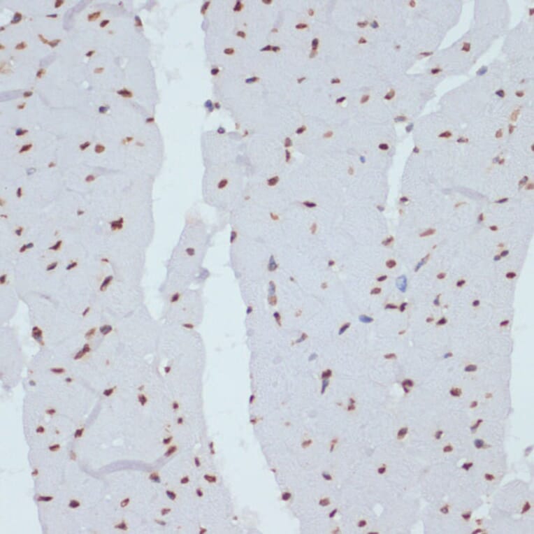 Immunohistochemistry - Anti-Chk1 (phospho Ser280) Antibody (A12451) - Antibodies.com