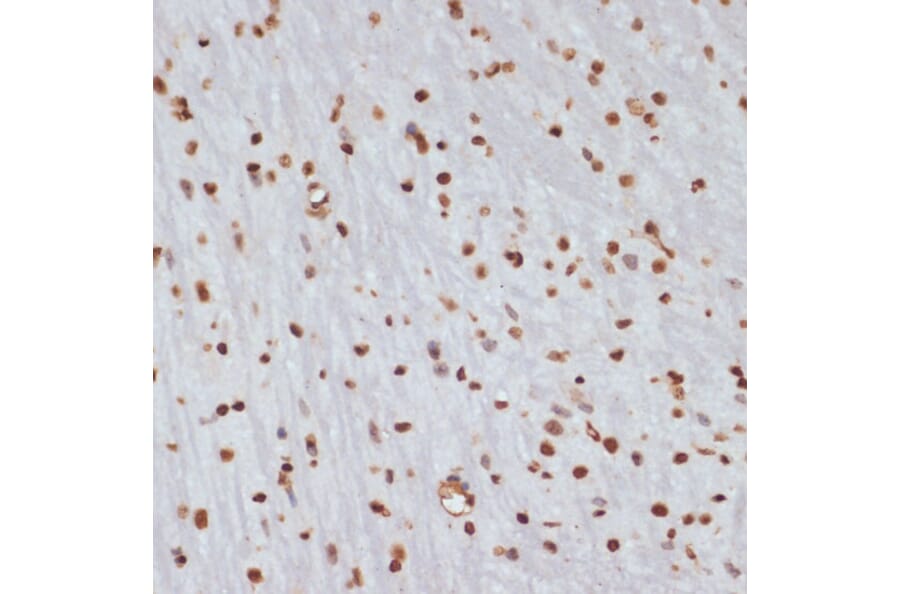 Immunohistochemistry - Anti-Chk1 (phospho Ser280) Antibody (A12451) - Antibodies.com