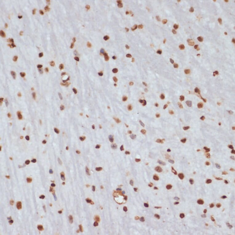 Immunohistochemistry - Anti-Chk1 (phospho Ser280) Antibody (A12451) - Antibodies.com