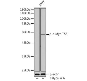 Western Blot - Anti-c-Myc (phospho Thr58) Antibody (A12454) - Antibodies.com
