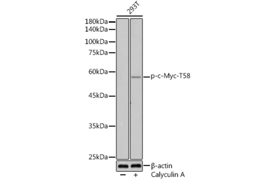 Western Blot - Anti-c-Myc (phospho Thr58) Antibody (A12454) - Antibodies.com