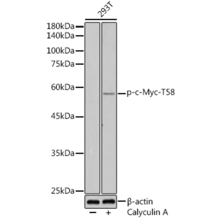 Western Blot - Anti-c-Myc (phospho Thr58) Antibody (A12454) - Antibodies.com