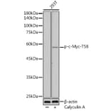 Western Blot - Anti-c-Myc (phospho Thr58) Antibody (A12454) - Antibodies.com