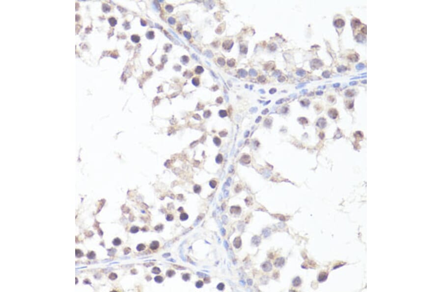 Immunohistochemistry - Anti-c-Myc (phospho Thr58) Antibody (A12454) - Antibodies.com