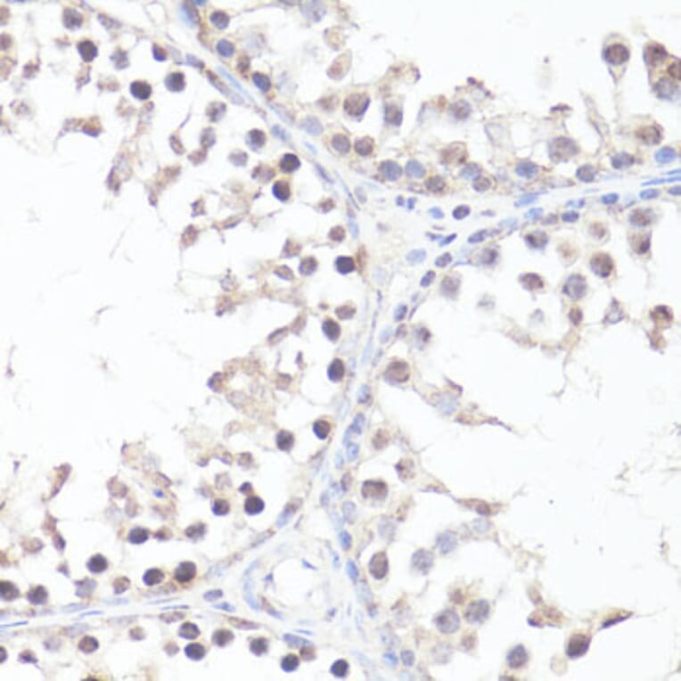 Immunohistochemistry - Anti-c-Myc (phospho Thr58) Antibody (A12454) - Antibodies.com