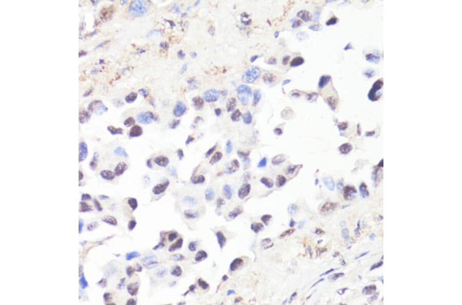 Immunohistochemistry - Anti-c-Myc (phospho Thr58) Antibody (A12454) - Antibodies.com