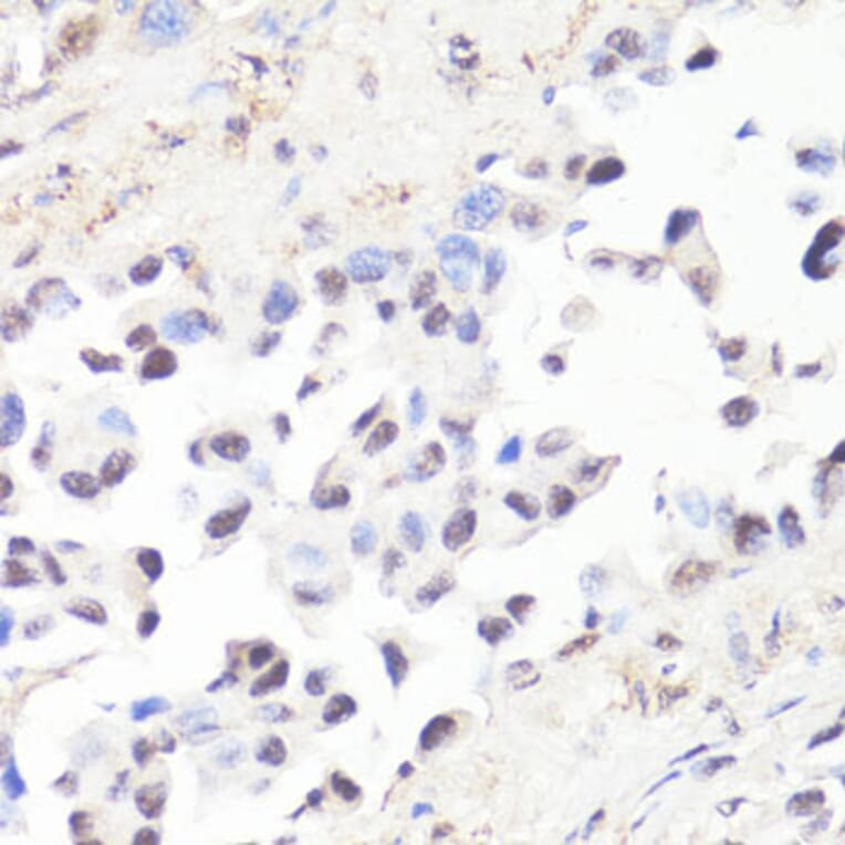 Immunohistochemistry - Anti-c-Myc (phospho Thr58) Antibody (A12454) - Antibodies.com