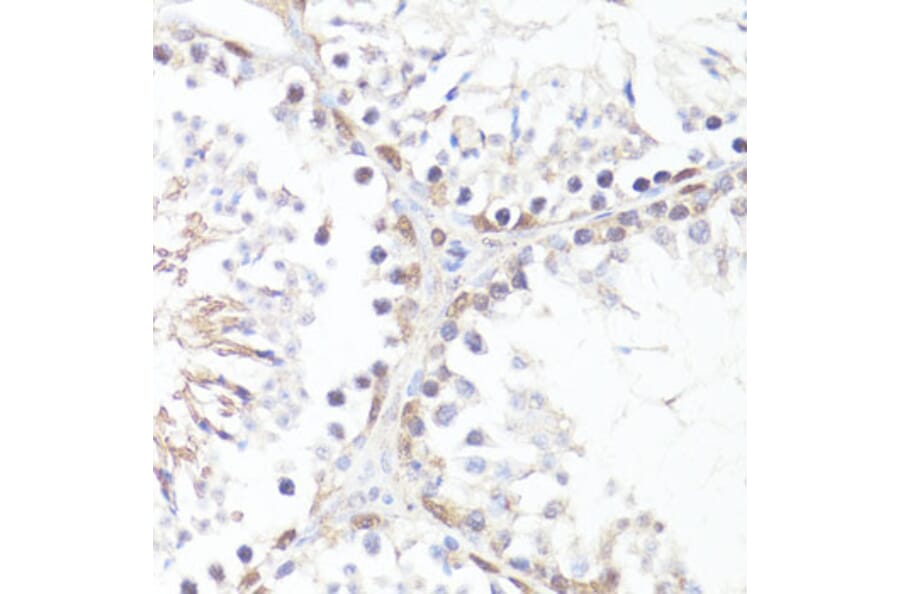 Immunohistochemistry - Anti-c-Myc (phospho Thr58) Antibody (A12454) - Antibodies.com