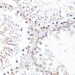 Immunohistochemistry - Anti-c-Myc (phospho Thr58) Antibody (A12454) - Antibodies.com