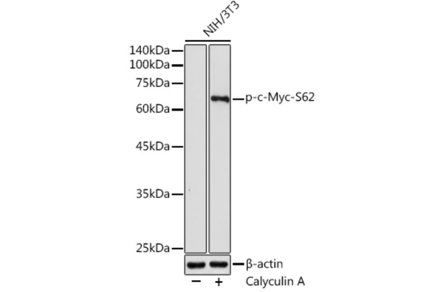 Western Blot - Anti-c-Myc (phospho Ser62) Antibody (A12455) - Antibodies.com