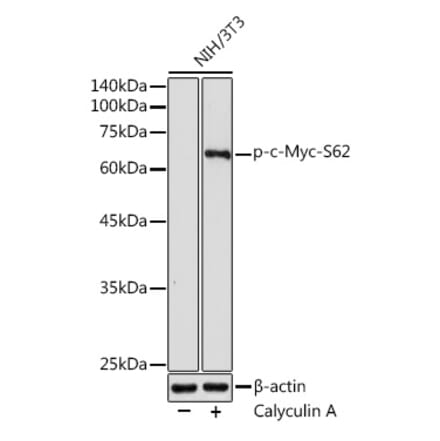Western Blot - Anti-c-Myc (phospho Ser62) Antibody (A12455) - Antibodies.com