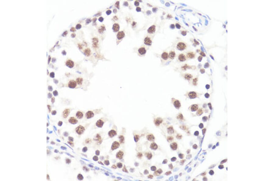 Immunohistochemistry - Anti-c-Myc (phospho Ser62) Antibody (A12455) - Antibodies.com