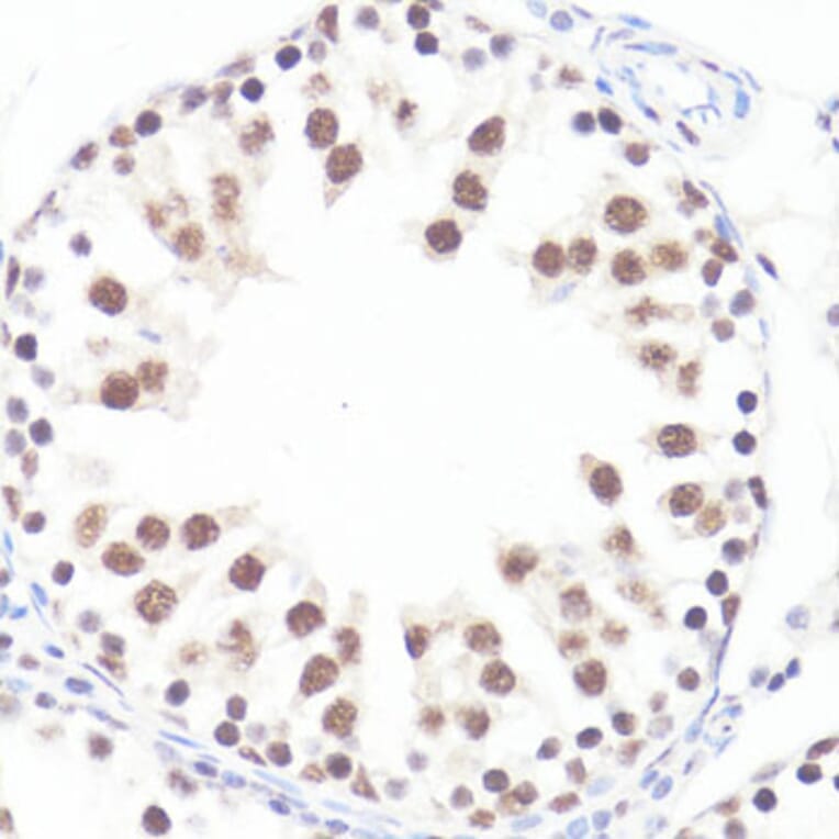 Immunohistochemistry - Anti-c-Myc (phospho Ser62) Antibody (A12455) - Antibodies.com