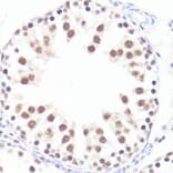 Immunohistochemistry - Anti-c-Myc (phospho Ser62) Antibody (A12455) - Antibodies.com