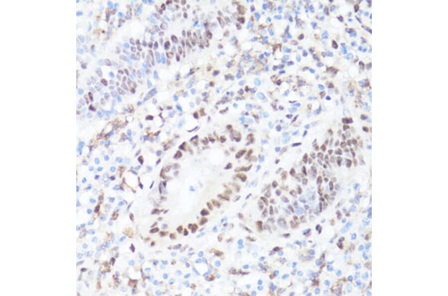 Immunohistochemistry - Anti-c-Myc (phospho Ser62) Antibody (A12455) - Antibodies.com