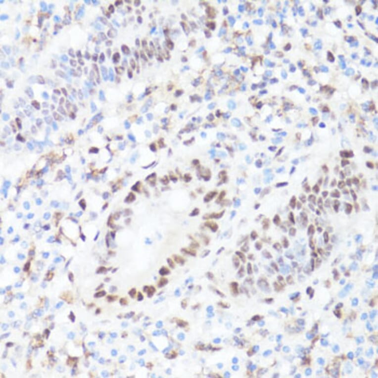 Immunohistochemistry - Anti-c-Myc (phospho Ser62) Antibody (A12455) - Antibodies.com