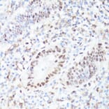 Immunohistochemistry - Anti-c-Myc (phospho Ser62) Antibody (A12455) - Antibodies.com