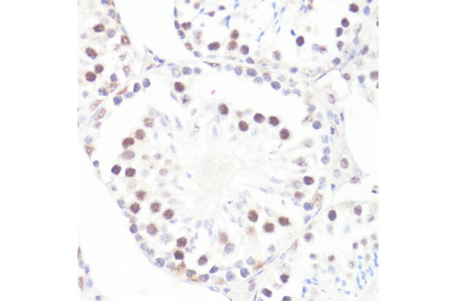 Immunohistochemistry - Anti-c-Myc (phospho Ser62) Antibody (A12455) - Antibodies.com