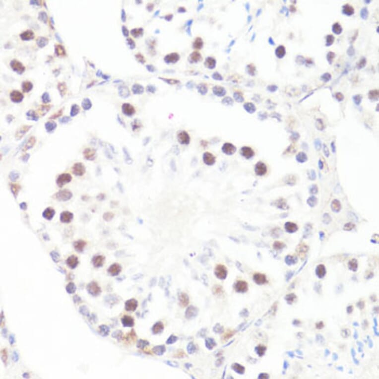 Immunohistochemistry - Anti-c-Myc (phospho Ser62) Antibody (A12455) - Antibodies.com