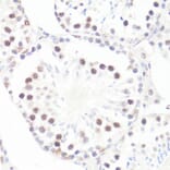 Immunohistochemistry - Anti-c-Myc (phospho Ser62) Antibody (A12455) - Antibodies.com