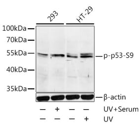 Western Blot - Anti-p53 (phospho Ser9) Antibody (A12456) - Antibodies.com