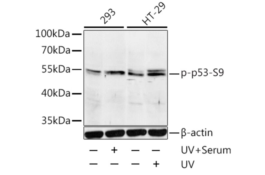 Western Blot - Anti-p53 (phospho Ser9) Antibody (A12456) - Antibodies.com