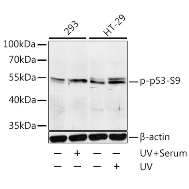 Western Blot - Anti-p53 (phospho Ser9) Antibody (A12456) - Antibodies.com