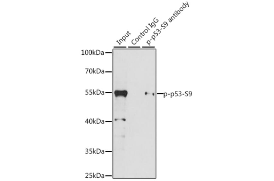 Western Blot - Anti-p53 (phospho Ser9) Antibody (A12456) - Antibodies.com