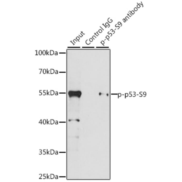 Western Blot - Anti-p53 (phospho Ser9) Antibody (A12456) - Antibodies.com