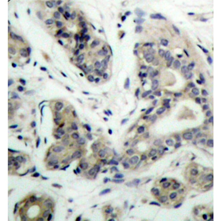 Immunohistochemistry - Anti-Bad (phospho S136) Antibody (AP0144) - Antibodies.com