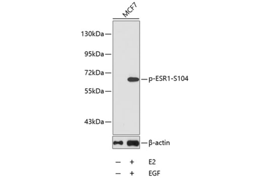 Western Blot - Anti-ESR1 (phospho S104) Antibody (AP0145) - Antibodies.com