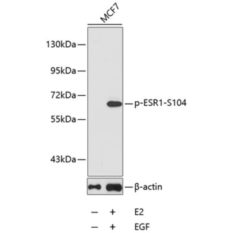 Western Blot - Anti-ESR1 (phospho S104) Antibody (AP0145) - Antibodies.com