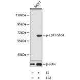 Western Blot - Anti-ESR1 (phospho S104) Antibody (AP0145) - Antibodies.com
