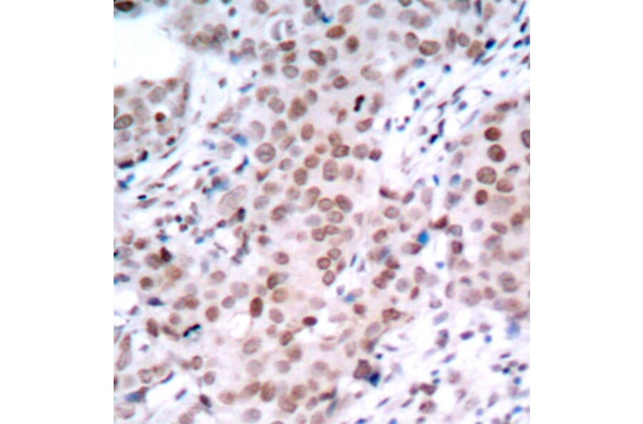 Immunohistochemistry - Anti-ESR1 (phospho S104) Antibody (AP0145) - Antibodies.com