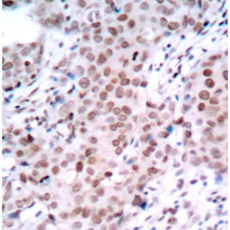 Immunohistochemistry - Anti-ESR1 (phospho S104) Antibody (AP0145) - Antibodies.com