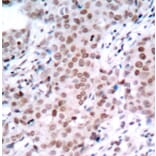 Immunohistochemistry - Anti-ESR1 (phospho S104) Antibody (AP0145) - Antibodies.com